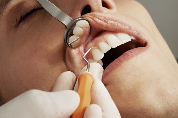 Instrumentos odontologicos em procedimento dentario